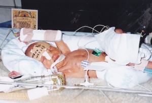 Ethan-in-NICU